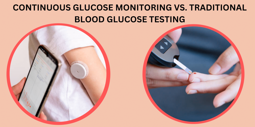 Continuous Glucose Monitoring: A Comprehensive Guide