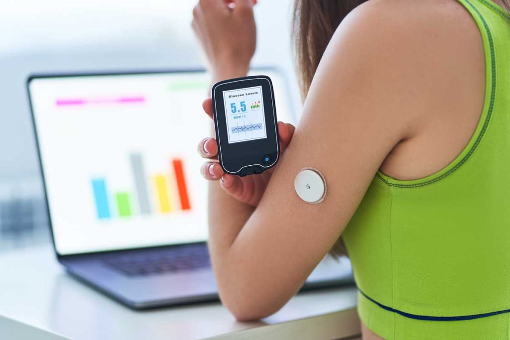 Continuous Glucose Monitoring: A Comprehensive Guide